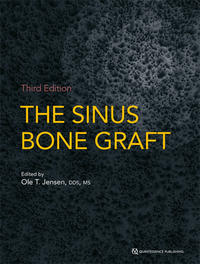 The Sinus Bone Graft