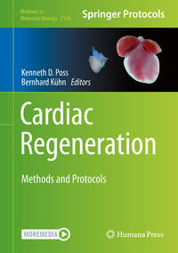 Cardiac Regeneration