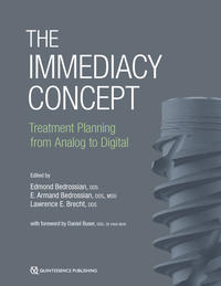 The Immediacy Concept