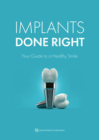 Implants Done Right