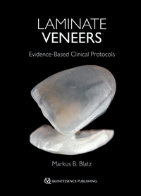 Laminate Veneers