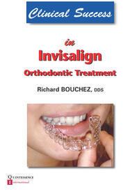 Clinical Success in Invisalign Orthodontic Treatment