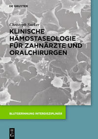 Klinische Hämostaseologie für Zahnärzte und Oralchirurgen