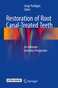 Restoration of Root Canal-Treated Teeth