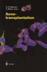 Xenotransplantation