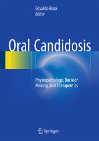 Oral Candidosis