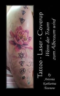 Tattoo - Laser - Cover Up