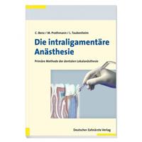 Die intraligamentäre Anästhesie