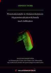 Penetrationstiefe in Molaren-Inzisiven-Hypomineralisation-Schmelz nach Infiltration