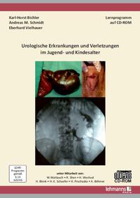 Urologische Erkrankungen und Verletzungen im Jugend- und Kindesalter