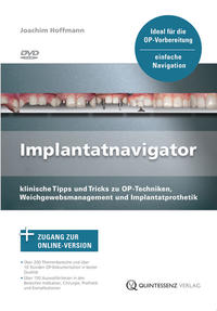 Implantatnavigator