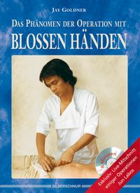 Das Phänomen der Operation mit blossen Händen