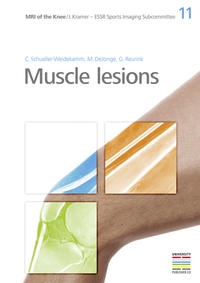 11. Muscle lesions