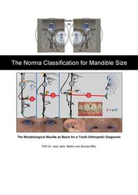 The Norma Classification for Mandible Size